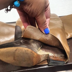 Сложная реставрация